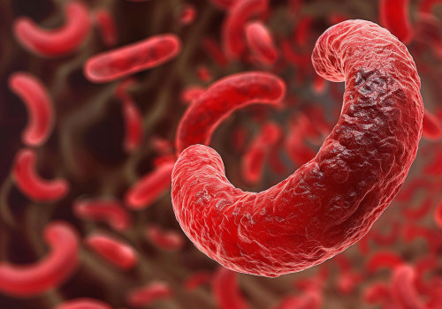 Difference Between Sickle Cell Anemia and Disease? Discover Why It Matters for Your Health and Long-Term Care Decisions